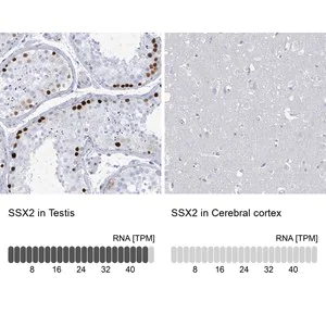 Merck Anti-SSX2 antibody produced in rabbit