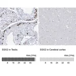 Merck Anti-SSX2 antibody produced in rabbit