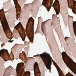 Merck Anti-TPM3 antibody produced in rabbit