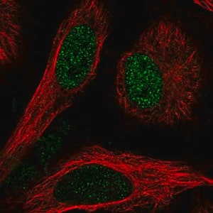 Merck Anti-TBL1X antibody produced in rabbit