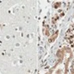 Merck Anti-Transcription Initiation Factor IIA subunit 1