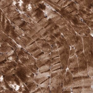 Merck Anti-MLXIP antibody produced in rabbit