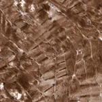 Merck Anti-MLXIP antibody produced in rabbit