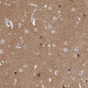 Merck Anti-PPP1R9A antibody produced in rabbit