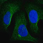 Merck Anti-TNKS2 antibody produced in rabbit