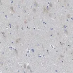Merck Anti-ITPR1 antibody produced in rabbit
