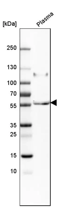 Merck Anti-PI16 antibody produced in rabbit
