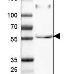 Merck Anti-PI16 antibody produced in rabbit