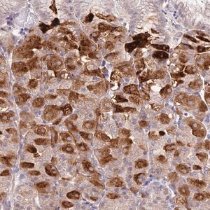 Merck Anti-METTL26 antibody produced in rabbit