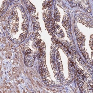 Merck Anti-C6 antibody produced in rabbit