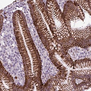 Merck Anti-ZNF667 antibody produced in rabbit