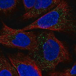 Merck Anti-ESPN antibody produced in rabbit