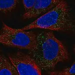 Merck Anti-ESPN antibody produced in rabbit