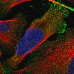 Merck Anti-RASAL2 antibody produced in rabbit