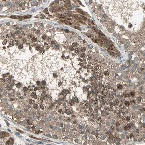 Merck Anti-ZNF608 antibody produced in rabbit