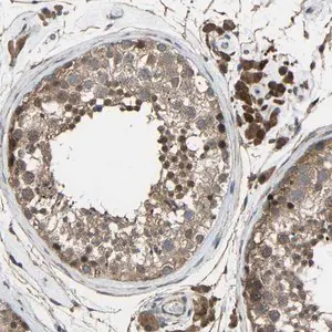 Merck Anti-CHST9 antibody produced in rabbit