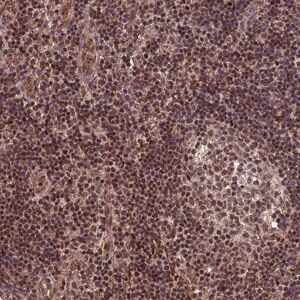 Merck Anti-CABIN1 antibody produced in rabbit