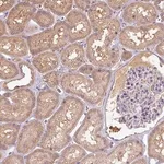 Merck Anti-TSEN54 antibody produced in rabbit