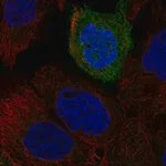 Merck Anti-TACR2 antibody produced in rabbit