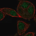 Merck Anti-CYB5RL antibody produced in rabbit