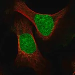 Merck Anti-ESCO2 antibody produced in rabbit