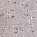 Merck Anti-NLK antibody produced in rabbit