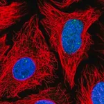 Merck Anti-TOE1 antibody produced in rabbit