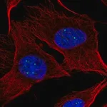Merck Anti-NPAT antibody produced in rabbit