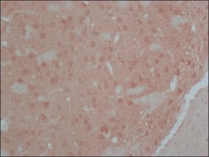 Merck Anti-Calcineurin (α-Subunit) antibody, Mouse monoclonal