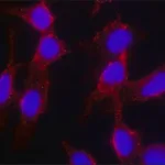 Merck Anti-Cholera toxin, B Subunit (CTxB) antibody, Mouse monoclonal