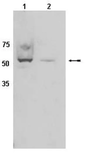 Merck Anti-CYP450 Antibody, clone 2E1