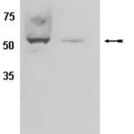 Merck Anti-CYP450 Antibody, clone 2E1