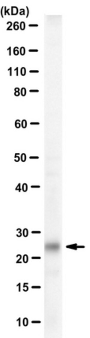 Merck Anti-Tentonin 3/TMEM150c