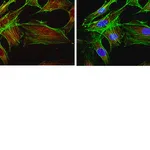 Merck Anti-FOXO1 Antibody, clone 2H8.2
