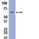 Merck Anti-Perilipin A Antibody