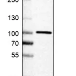 Merck Anti-APPL1