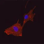 Merck Anti-α Actinin antibody, Mouse monoclonal