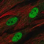 Merck Anti-C1orf204 antibody produced in rabbit