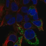 Merck Anti-D2HGDH antibody produced in rabbit