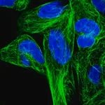 Merck Anti-RPL6 antibody produced in rabbit
