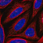 Merck Anti-CEP164 antibody produced in rabbit