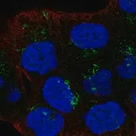 Merck Anti-LTBR antibody produced in rabbit