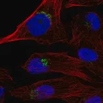 Merck Anti-TPST1 antibody produced in rabbit