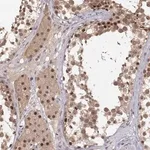 Merck Anti-CSNK2A1 antibody produced in rabbit