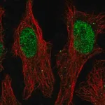 Merck Anti-ZNF320 antibody produced in rabbit