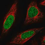 Merck Anti-ABCA5 antibody produced in rabbit