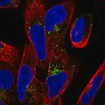 Merck Anti-TMEM123 antibody produced in rabbit