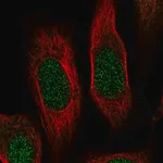 Merck Anti-RPS19 antibody produced in rabbit