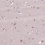 Merck Anti-CPT1C antibody produced in rabbit