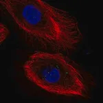 Merck Anti-IL20RB antibody produced in rabbit